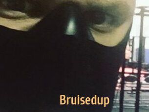 Bruisedup
